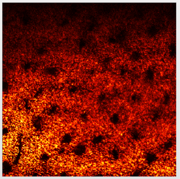 Laser Scanning Confocal Microscope System 2